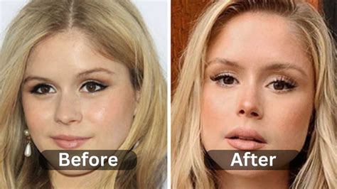 erin moriaty plastic surgery|Erin Moriarty Responds to Plastic Surgery Backlash